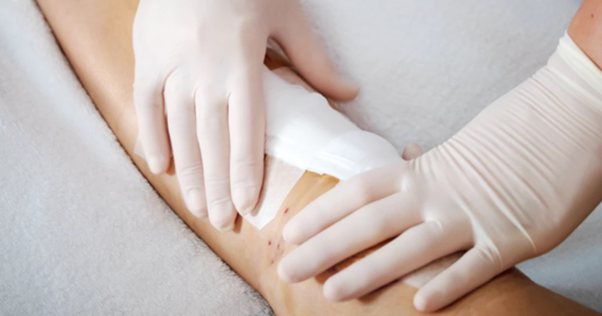 مراحل صحیح پانسمان اضطراری