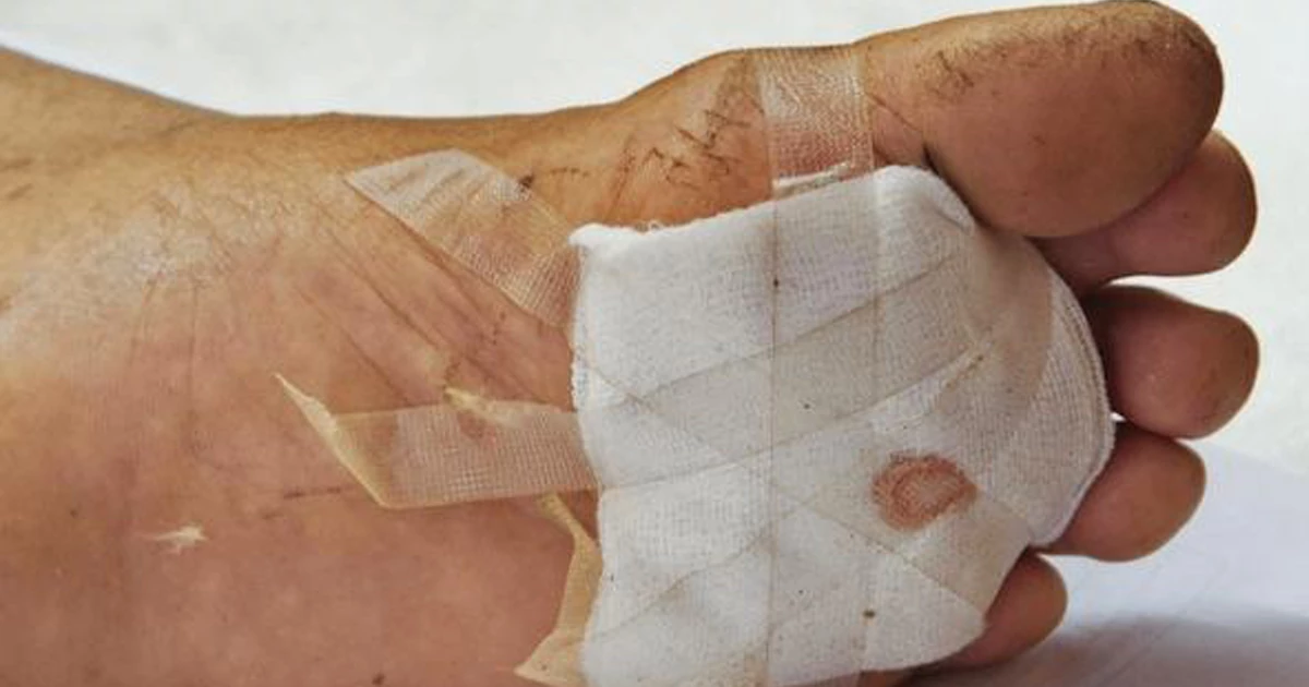 استفاده از جایگزینهای خانگی