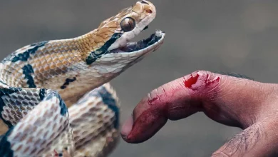 اقدام در مقابل گزش جانوران زهری (سمی)/ مار گزیدگی